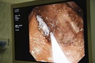 Úkoly vědomostně-dovednostní soutěže Medik roku 2015